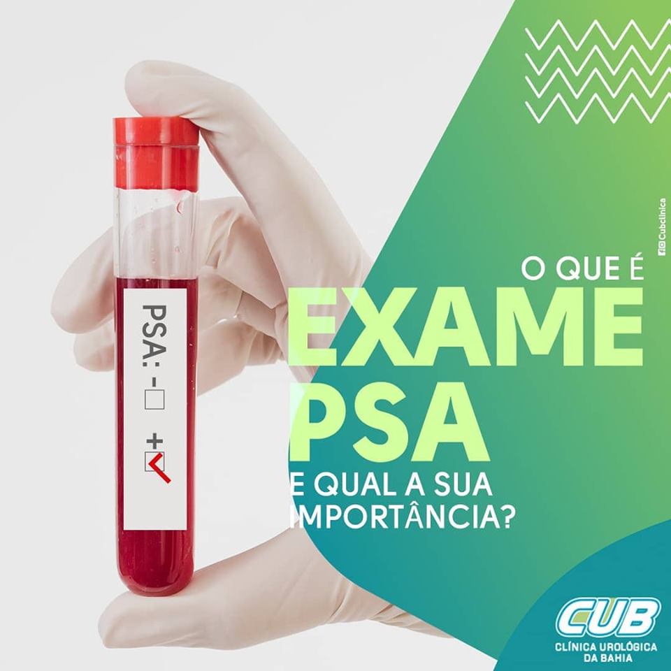 Exame PSA: Saiba Mais e Faça Agora