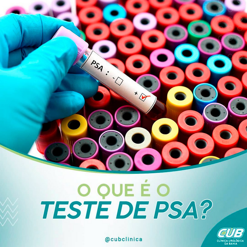 O que é o teste de PSA? CUB Clínica Urológica da Bahia Urologista em Salvador. O que é o teste de PSA? CUB Clínica Urológica da Bahia Urologista em Salvador.